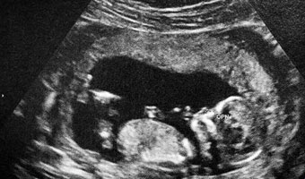 L’éveil de bébé pendant la grossesse